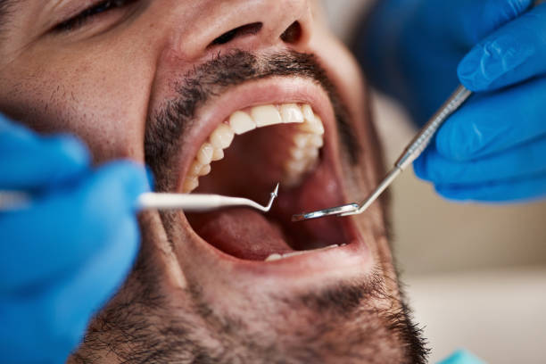 Best Emergency Dental Care for Trauma or Injury in Selma, NC